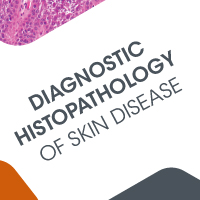 DIAGNOSTIC_HISTOPATHOLOGY__OF_SKIN_DISEASE
